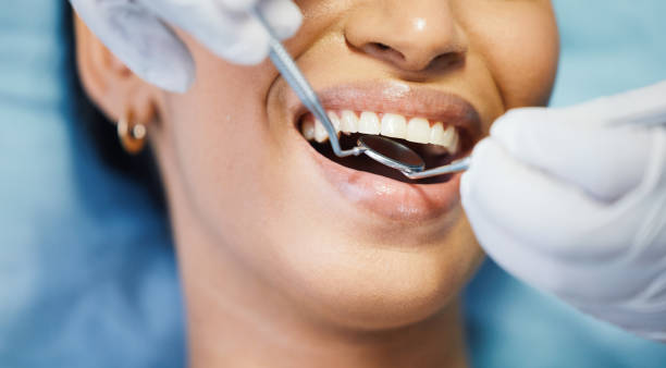 Best Emergency Root Canal Treatment in Clinton, OH