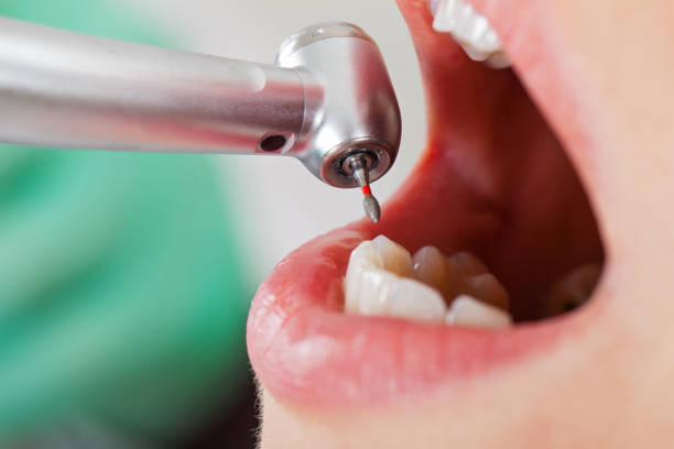 Best After-Hours Dental Trauma Care in Clinton, OH